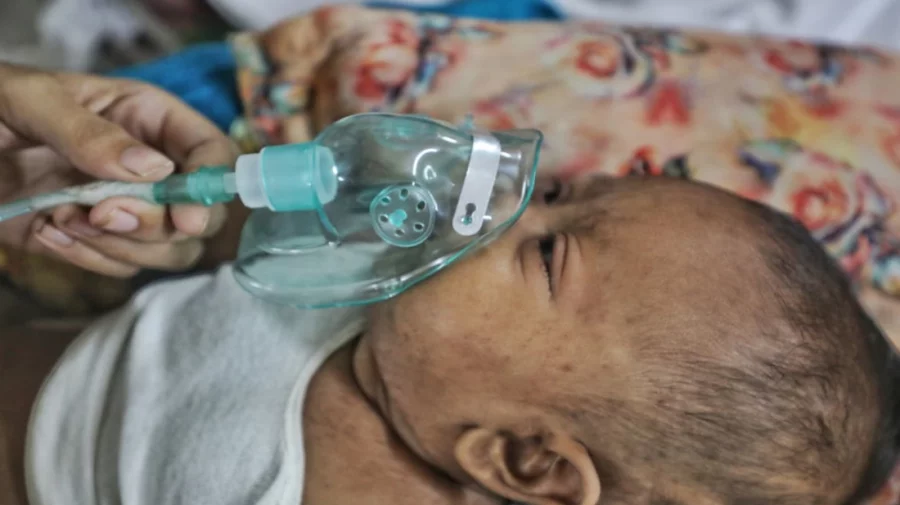 Measles outbreak: Death toll reaches 652 as 4 children die in 24 hours